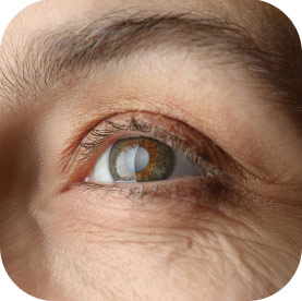 Glaucoma & Cataract evaluations